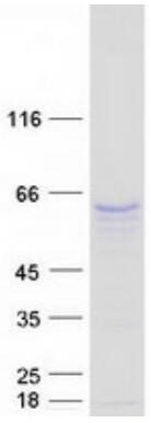 Coomassie blue staining of purified TRAF6 protein.